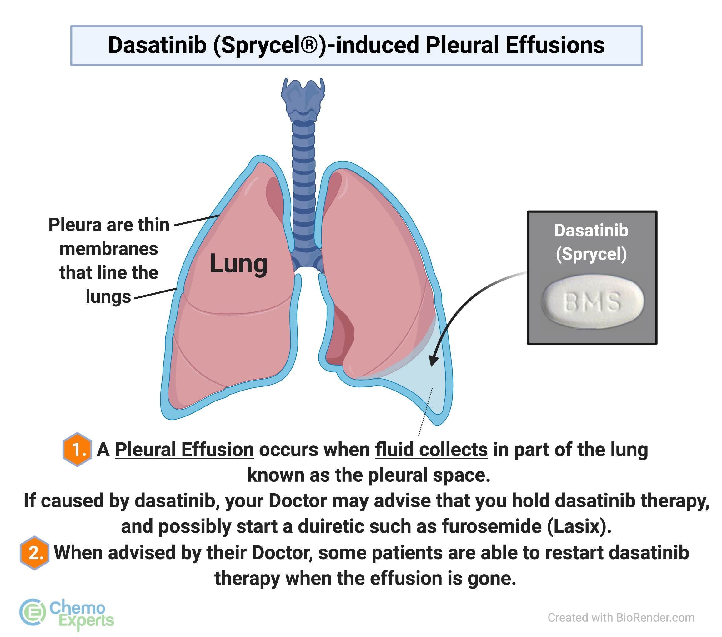 Dasatinib (Sprycel) for leukemia CML ChemoExperts