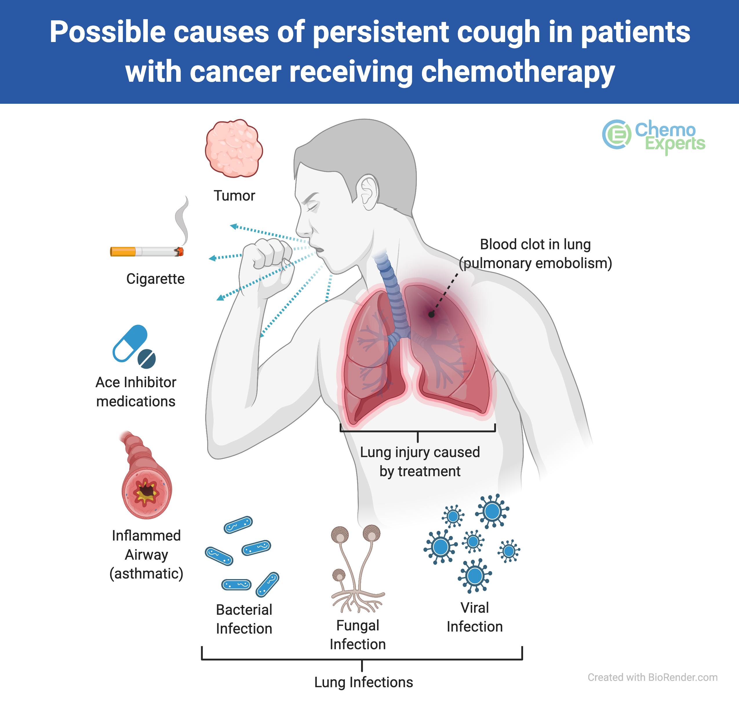 The Importance of Coughing After Surgery