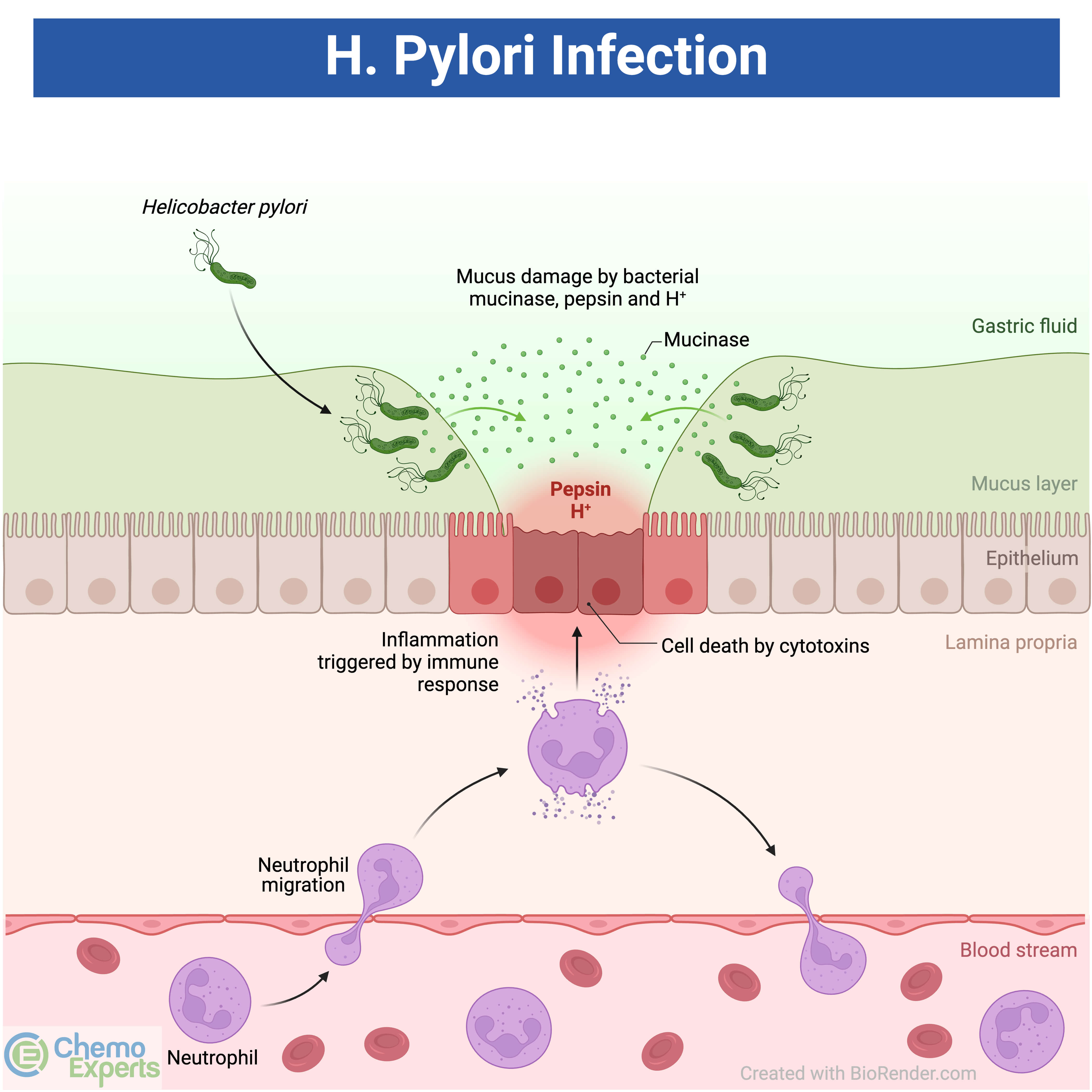 h.pylori.infection